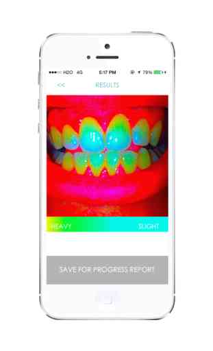 Smile - Dental Hygiene Analysis 2