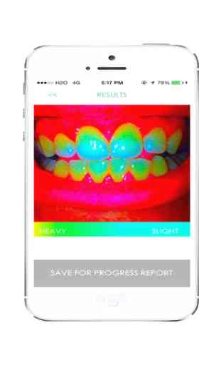 Smile - Dental Hygiene Analysis 3