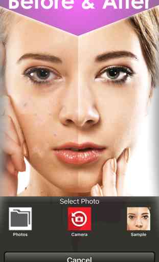Beauty camera for perfect skin , acne eraser & wrinkles remover and blemish 3