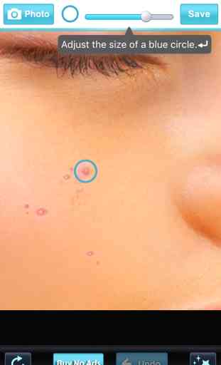 Beauty Face - Pimple Eraser 2