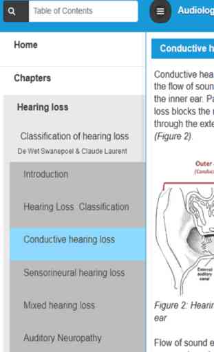 Audiology and Hearing Aids for Otolaryngologist 1