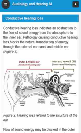 Audiology and Hearing Aids for Otolaryngologist 2