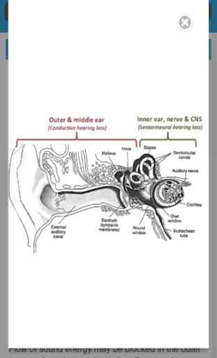 Audiology and Hearing Aids for Otolaryngologist 3