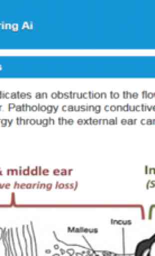 Audiology and Hearing Aids for Otolaryngologist 4