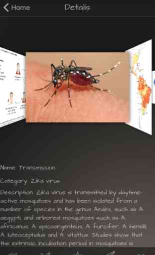 Zika Virus Infection 2