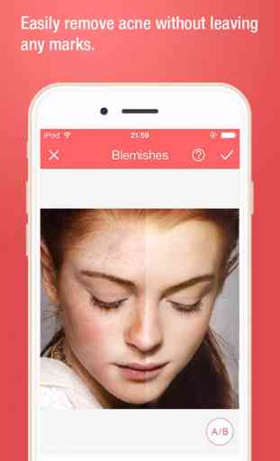 Beautify Cam-remove your face acne and blemish 3