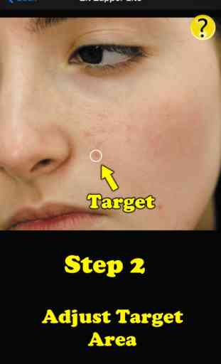 Zit Zapper Lite - Airbrush your face and remove pimples and acne 3