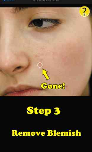Zit Zapper Lite - Airbrush your face and remove pimples and acne 4