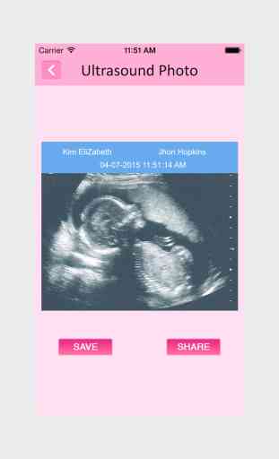 Ultrasound Spoof - Pregnancy Prank App 2