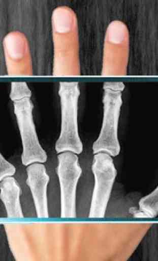 X-Ray Scanner Prank 1