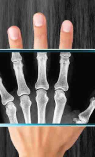 X-Ray Scanner Prank 4