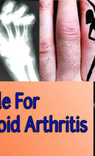 Guide for Rheumatoid Arthritis 2