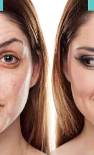 Acne Free : Pimple Remover 1