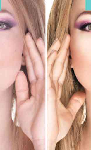 Acne Free : Pimple Remover 4