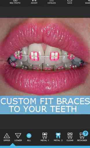 Braces Teeth Booth Pro Camera 1
