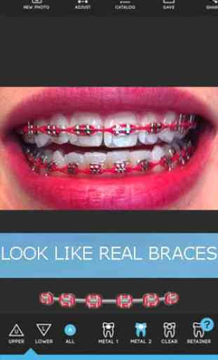 Braces Teeth Booth Pro Camera 4