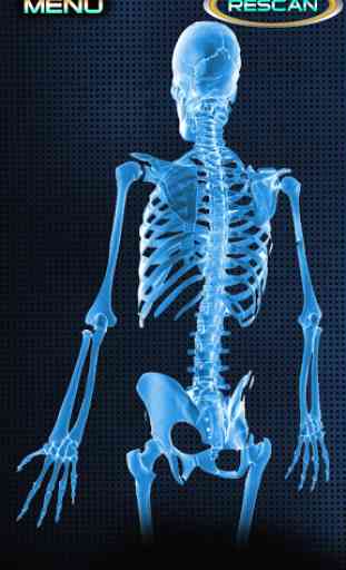 X-Ray Full Body Prank 2