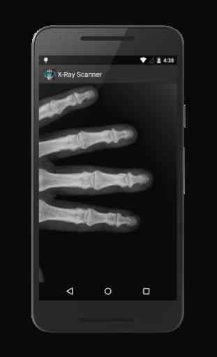 X-Ray Scanner Prank 1