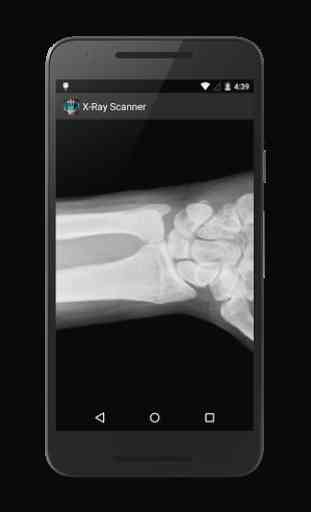 X-Ray Scanner Prank 3