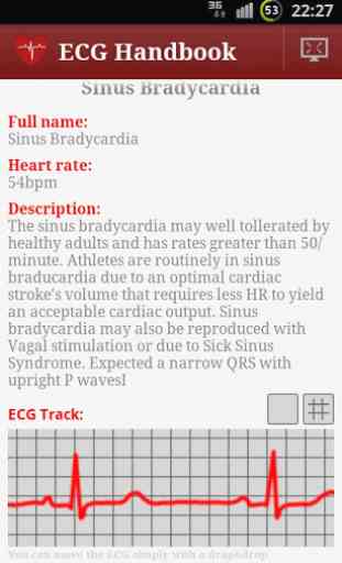 Heart ECG Handbook - Lite 3