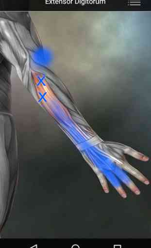 Muscle Trigger Point Anatomy 4