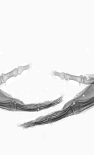 Radiographic Anatomy X-Ray 1