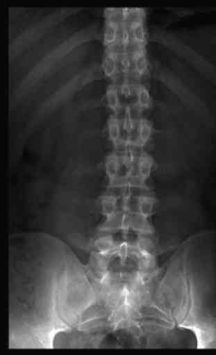 Radiographic Anatomy X-Ray 4