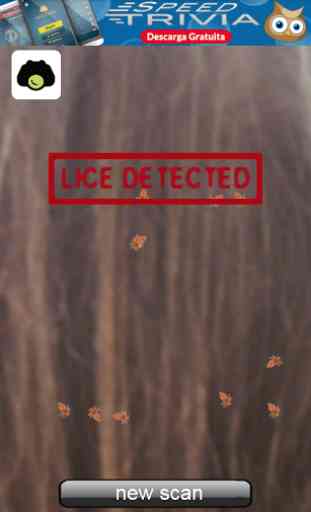 Lice Detector (prank) 3