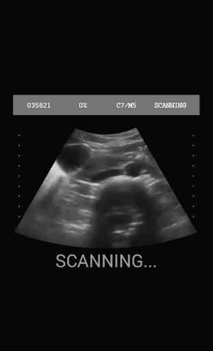 Pregnancy Test Simulator 3