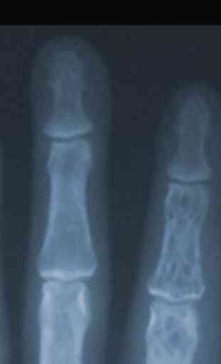 X-ray Scanner Prank 2