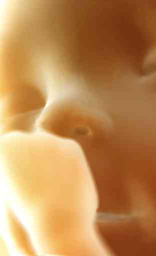 Baby Heart Doppler - Obstetric 3