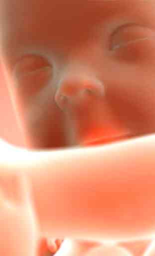 Baby Heart Doppler - Obstetric 4