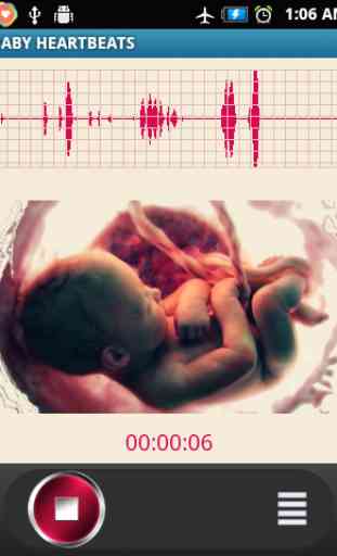 Baby Heartbeats Lite 1