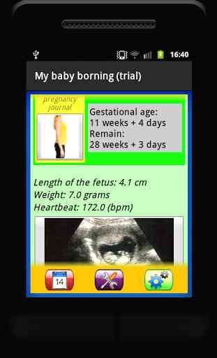 My baby borning (trial) 4