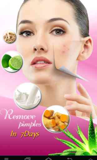 Pimple Remedies 4