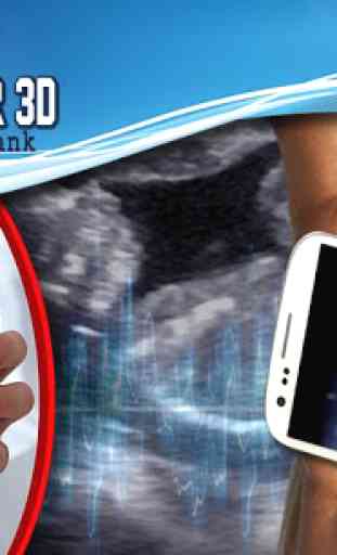 Ultrasound Scanner 3D Prank 1