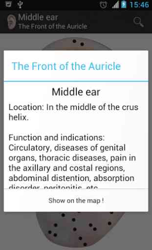 AcuMap EAR 2