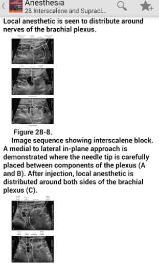 Atlas Ultrasound Anesthesia TR 2