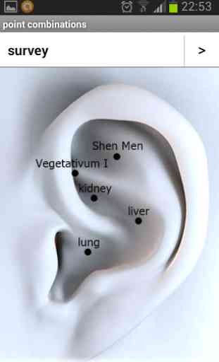 Ear Acupuncture 3