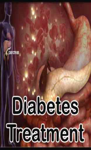 Diabetes Treatment 1
