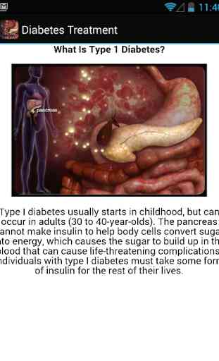 Diabetes Treatment 3