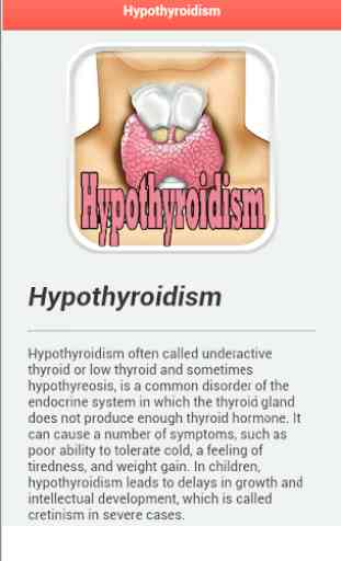 Hypothyroidism Disease 2