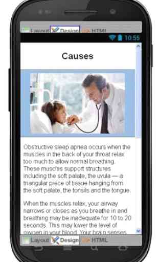 Obstructive Sleep Apnea 4