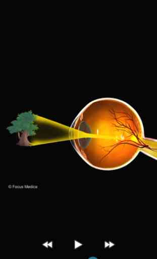 Ophthalmology- Dictionary 3