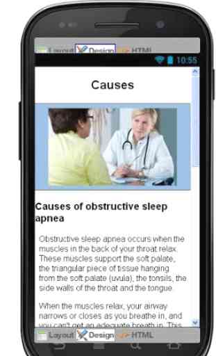 Sleep Apnea Disease & Symptoms 4