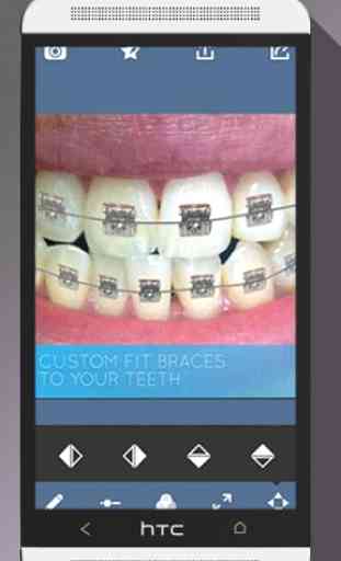 Braces Teeth Booth Camera Pro 4