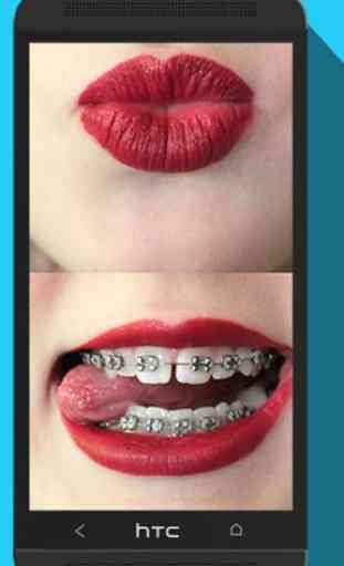 Braces Teeth Booth Maker Pro 1