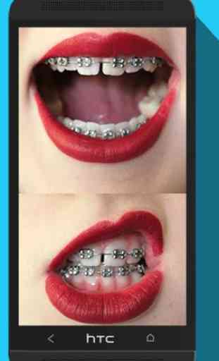 Braces Teeth Booth Maker Pro 2