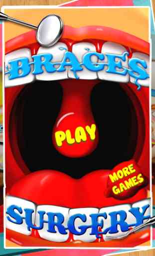 Braces Surgery Dentist Game 1