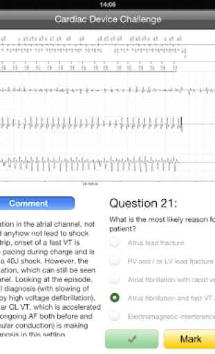 Cardiac Device Challenge PRO 3